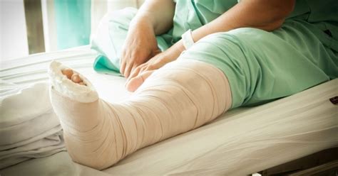 Broken leg treatment in Coimbatore: Know how therapy works | Sri Ramakrishna Hospital