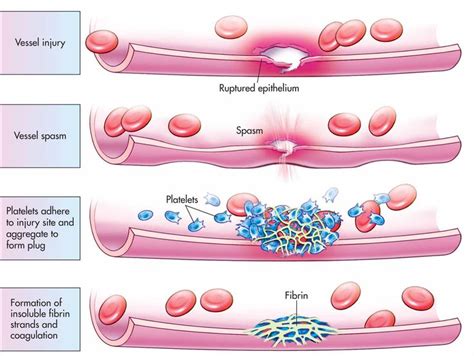 Basic steps in hemostasis. - Biology Forums Gallery | Medical school ...