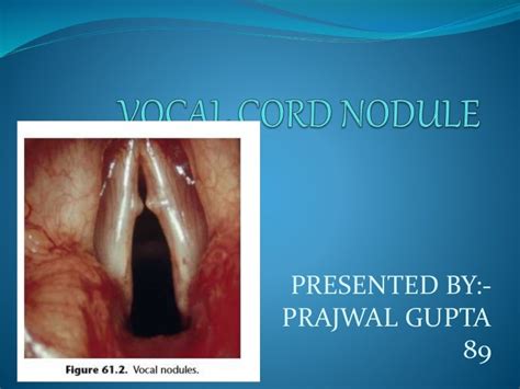 Vocal Nodules