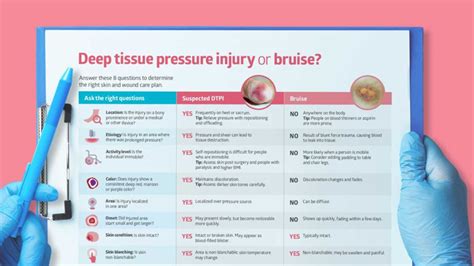 Deep tissue pressure injury vs. bruise: Know the differences