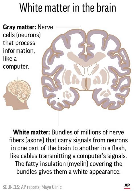 Doctors find brain abnormalities in victims of Cuba mystery