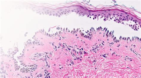 Dermatopathology