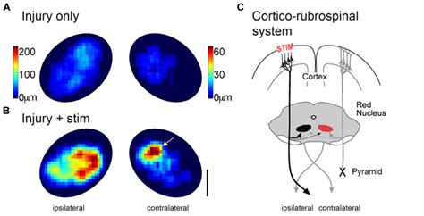 Motor cortex stimulation causes robust outgrowth to the magnocellular... | Download Scientific ...