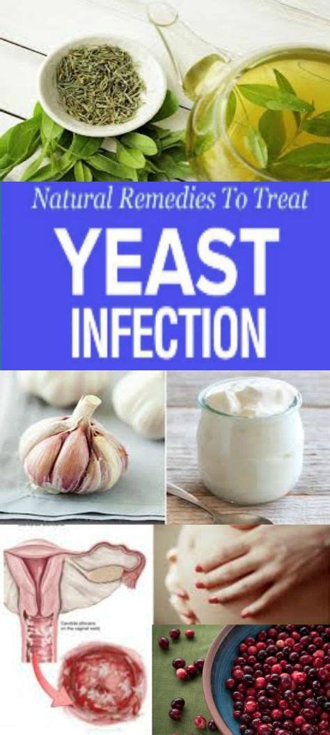 Natural Remedies To Treat Yeast Infection (With images) | Treat yeast infection, Yeast infection ...