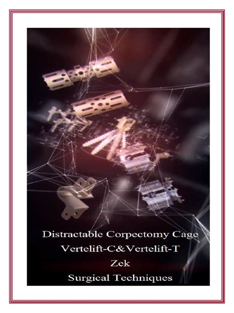 Surgical Techniques Corpectomy | PDF | Vertebra | Vertebral Column