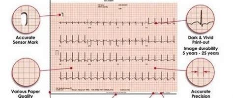 ECG Paper Wholesale Trader from Delhi