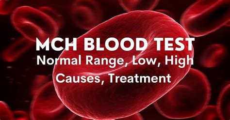 MCH Blood Test: High, Low, Symptoms, Treatments, Complete Details – DoctorOnHealth