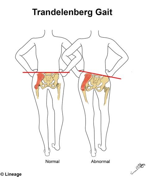 Superior Gluteal Nerve | 100% Best Guide | USMLE Strike