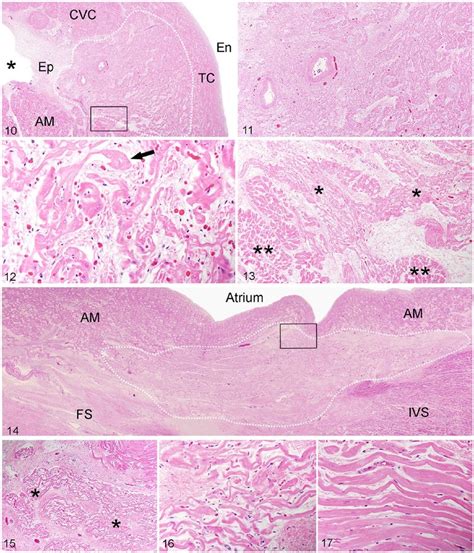 Histology of the sinoatrial node (SAN). H&E. Figure 10. Outline of the... | Download Scientific ...