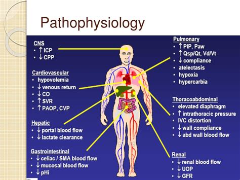 PPT - Abdominal Compartment Syndrome in Trauma PowerPoint Presentation - ID:892550