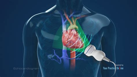 Echocardiogram Video | Medical Video Library