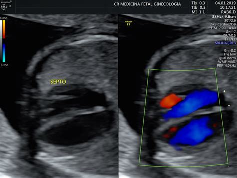 Anomaly Scan – CR Fetal Medicine