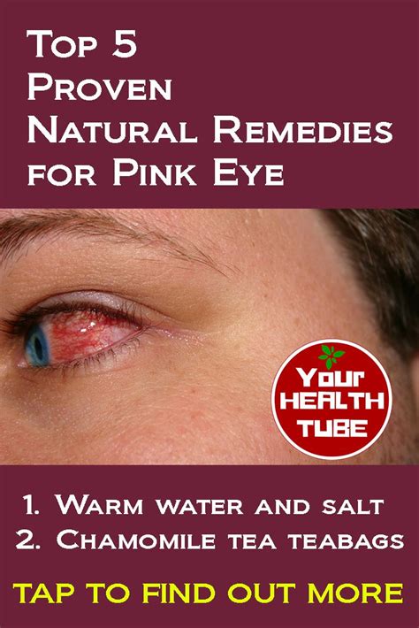 #herbs #eye #health | Natural pink eye remedy, Natural remedies ...