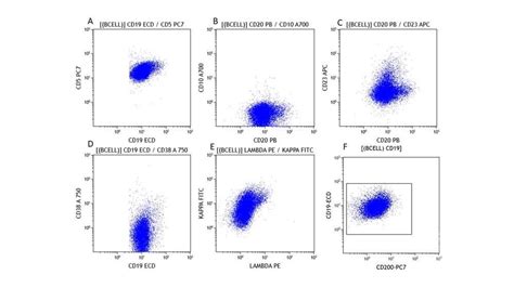 Flow cytometry of the lymph node biopsy