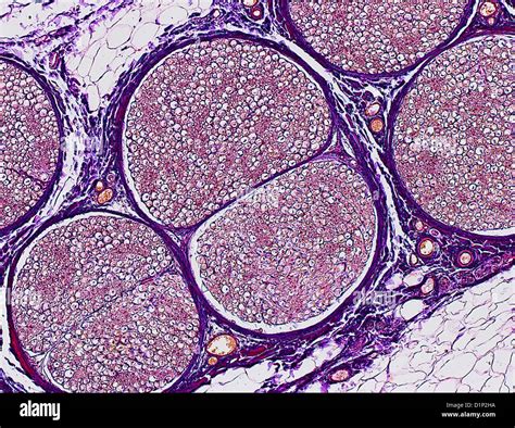 Nerve Tissue High Resolution Stock Photography and Images - Alamy