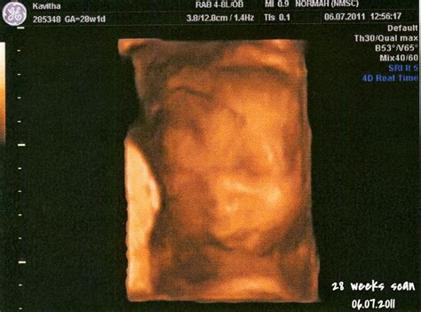 Ruthies's Journal: 28 Weeks 2D & 3D/4D Ultrasound Scan Photos