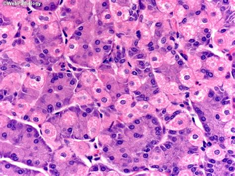 Neuroendocrine cells