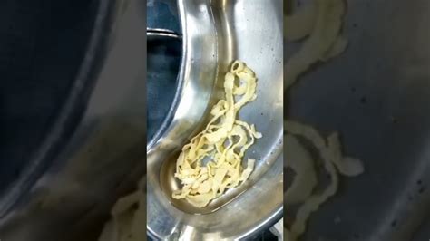 Tapeworm (cestodes) Surgical Removal In A Patient | Informative Video - YouTube