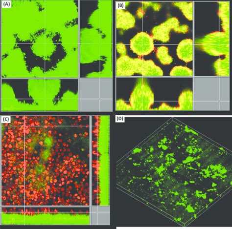 Pseudomonas aeruginosa biofilms. (A–C) In vitro flow cell biofilms of... | Download Scientific ...