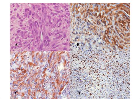 Histopathological features of tissue samples obtained during operation... | Download Scientific ...