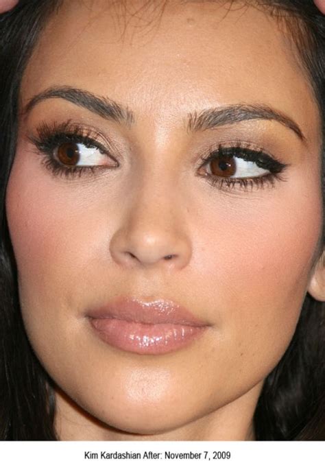 Chatter Busy: Kim Kardashian Nose job