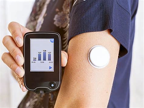 Flash glucose monitoring system | DIABETES SOUTH ARICA