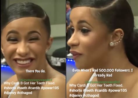 YouTube Short: Cardi B explains why she fixed her teeth