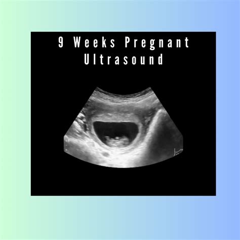 9 Weeks Pregnant Ultrasound: A Peek into Your Baby's Journey – creetify