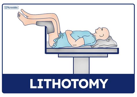 Dorsal Lithotomy Position