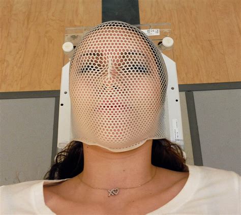 Cureus | The Continuous Assessment of Cranial Motion in Thermoplastic Masks During CyberKnife ...