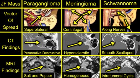 Everything You’ve Wanted to Know About Temporal Bone Imaging (But Were ...