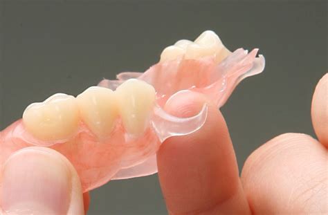 Flexible Partials | Hardin Dental Lab