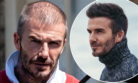 David Beckham Hiding Baldness - Foreign Policy