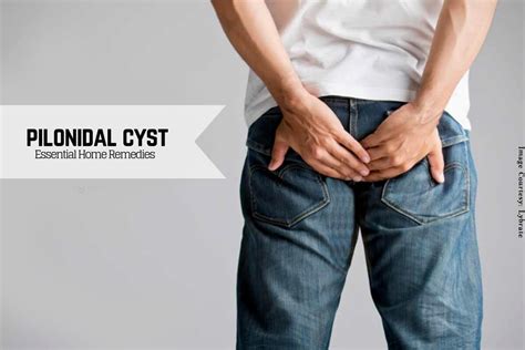 Pilonidal Cyst: Here's A Soothing Cure To This Painful Problem