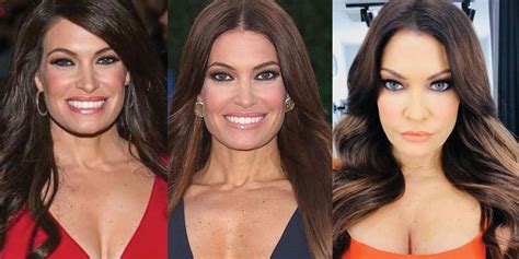 Kimberly Guilfoyle Plastic Surgery Before and After Pictures 2024