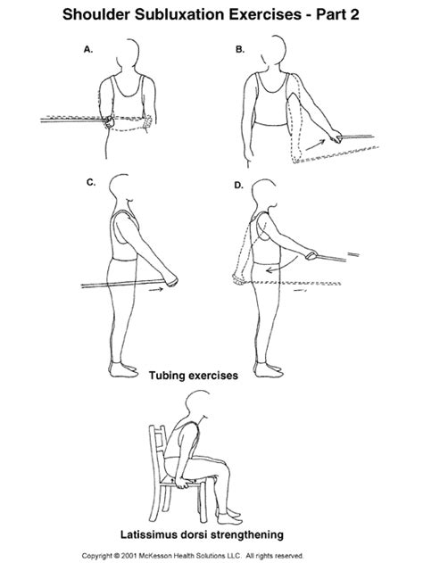 Sports Medicine Advisor 2003.1: Shoulder Subluxation Exercises, Part II: Illustration