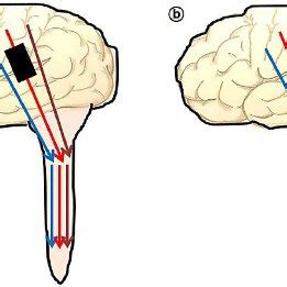 Illustration of electrical stimulation motor evoked potential pathway... | Download Scientific ...