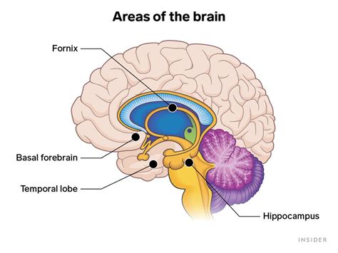 Retrograde Amnesia Brain