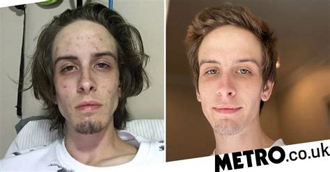 Drug addict posts inspiring before and after photos to celebrate recovery | Metro News