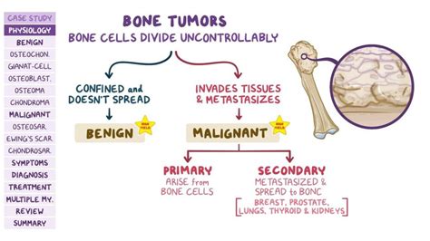 Diagnosis And Treatment Of Bone Tumors - Ask The Nurse Expert