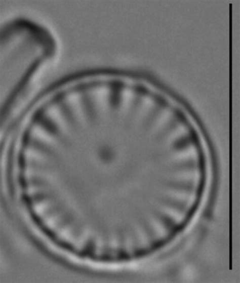 Compare Cyclotella meneghiniana | Species - Diatoms of North America