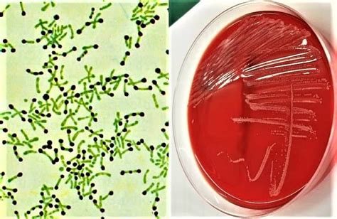 Corynebacterium Species Treatment