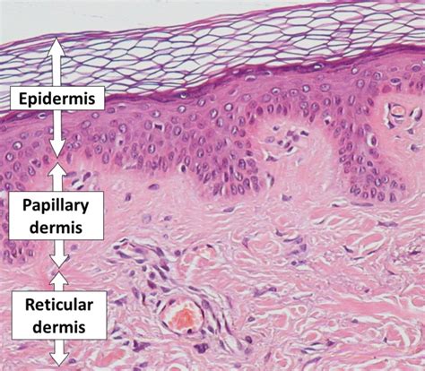 What is the Difference Between Papillary and Reticular Dermis - Pediaa.Com