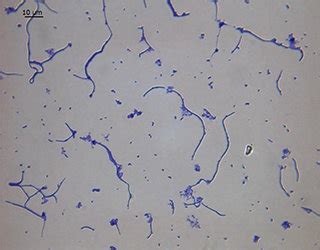 Lactobacillus Bulgaricus Gram Stain