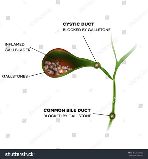 Pin auf Gastrointestinal tract