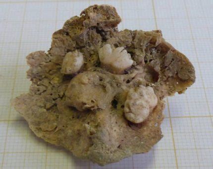 Teratoma time! – The History Blog