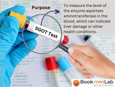 SGOT Test - Price, Purpose, Results & Report [2024]