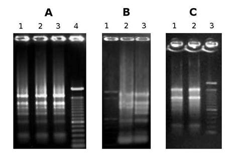 Rna Gel Electrophoresis