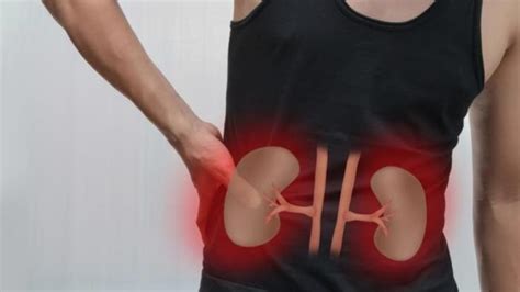 KIDNEY PAIN - Symptoms of a Kidney Infection, here's how to tell the difference from back pain ...