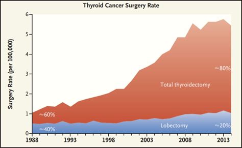 De-intensifying treatment for early thyroid cancer | STAT